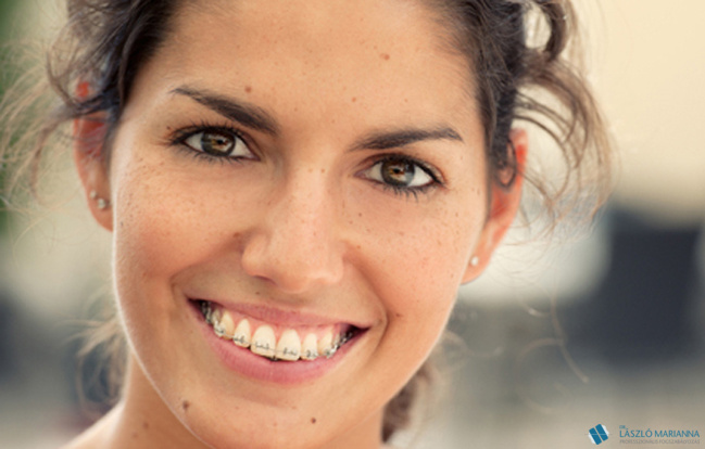 fog konturalas interproximalis redukcio