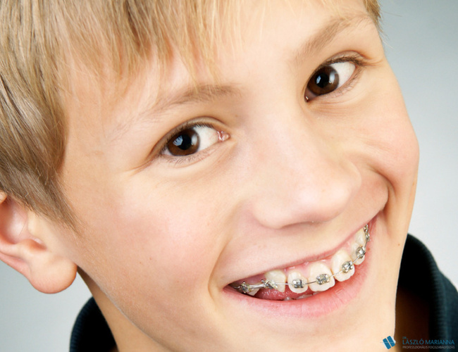 gyerek fogszabalyozas