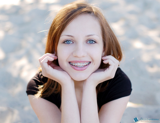 gyermekkori fogszabalyozas 3