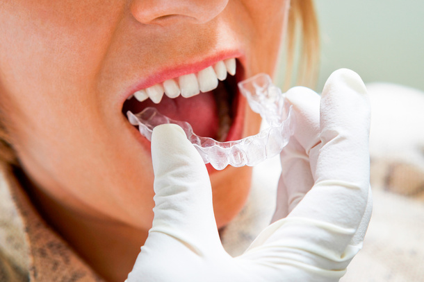 lathatatlan fogszabalyozas