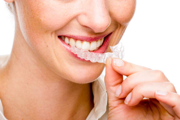 lathatatlan fogszabalyozas 4